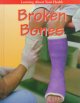 Broken bones  Cover Image